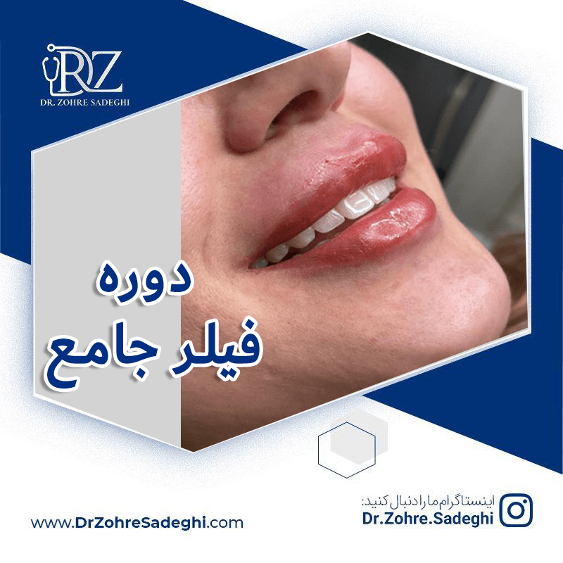 دوره فیلرجامع