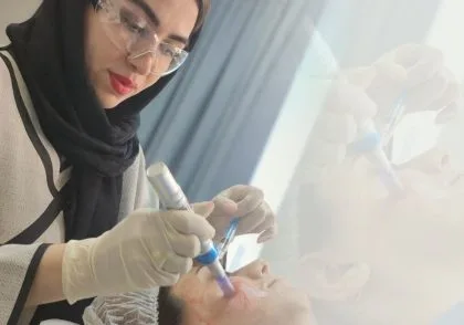مزوتراپی صورت