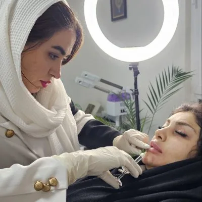 فیلر لب